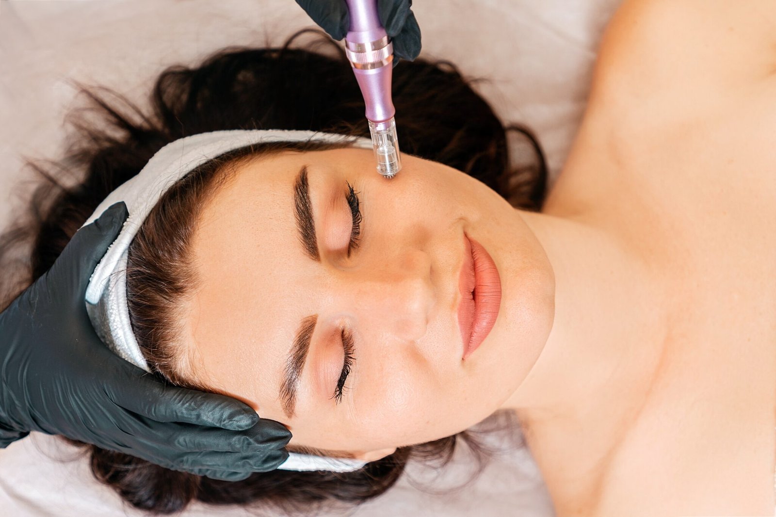 Professionelle Hautpflege. Microneedling, Schönheitsbehandlung der fraktionierten Mesotherapie des Frauengesichtes. Draufsicht. Konzept der Kosmetik und Dermatologie