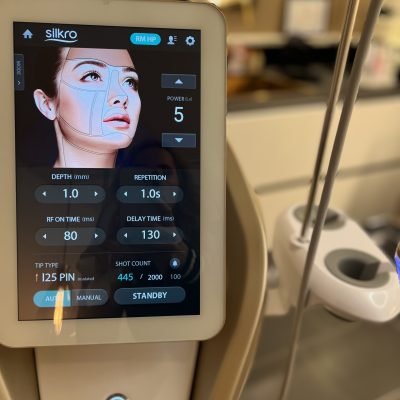 RF MICRONEEDLING